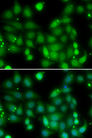 RORA / ROR Alpha Antibody - Immunofluorescence analysis of MCF7 cells.