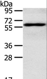 RORA / ROR Alpha Antibody - Western blot analysis of TM4 cell, using RORA Polyclonal Antibody at dilution of 1:400.