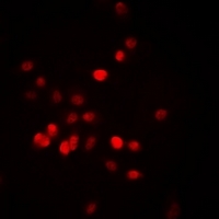 RORA / ROR Alpha Antibody - Immunofluorescent analysis of ROR alpha staining in MCF7 cells. Formalin-fixed cells were permeabilized with 0.1% Triton X-100 in TBS for 5-10 minutes and blocked with 3% BSA-PBS for 30 minutes at room temperature. Cells were probed with the primary antibody in 3% BSA-PBS and incubated overnight at 4 °C in a humidified chamber. Cells were washed with PBST and incubated with a DyLight 594-conjugated secondary antibody (red) in PBS at room temperature in the dark.