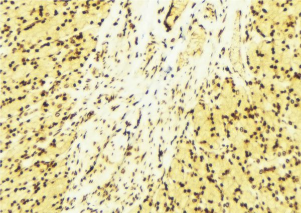RORA / ROR Alpha Antibody - 1:100 staining human gastric tissue by IHC-P. The sample was formaldehyde fixed and a heat mediated antigen retrieval step in citrate buffer was performed. The sample was then blocked and incubated with the antibody for 1.5 hours at 22°C. An HRP conjugated goat anti-rabbit antibody was used as the secondary.