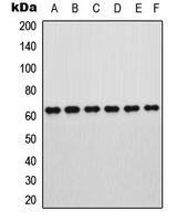 RORA / ROR Alpha Antibody - Western blot analysis of ROR alpha expression in HeLa (A); HEK293T (B); HepG2 (C); U266 (D); OPM2 (E); PC12 (F) whole cell lysates.