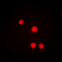 RORA / ROR Alpha Antibody - Immunofluorescent analysis of ROR alpha staining in HeLa cells. Formalin-fixed cells were permeabilized with 0.1% Triton X-100 in TBS for 5-10 minutes and blocked with 3% BSA-PBS for 30 minutes at room temperature. Cells were probed with the primary antibody in 3% BSA-PBS and incubated overnight at 4 deg C in a humidified chamber. Cells were washed with PBST and incubated with a DyLight 594-conjugated secondary antibody (red) in PBS at room temperature in the dark. DAPI was used to stain the cell nuclei (blue).