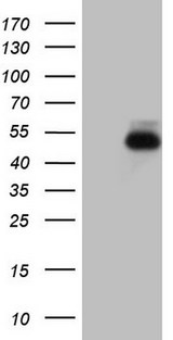 RORB / ROR Beta Antibody - HEK293T cells were transfected with the pCMV6-ENTRY control. (Left lane) or pCMV6-ENTRY RORB. (Right lane) cDNA for 48 hrs and lysed. Equivalent amounts of cell lysates. (5 ug per lane) were separated by SDS-PAGE and immunoblotted with anti-RORB. (1:2000)