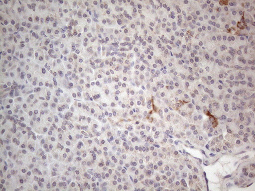 RORB / ROR Beta Antibody - Immunohistochemical staining of paraffin-embedded Human pancreas tissue within the normal limits using anti-RORB mouse monoclonal antibody. (Heat-induced epitope retrieval by 1mM EDTA in 10mM Tris buffer. (pH8.5) at 120°C for 3 min. (1:150)