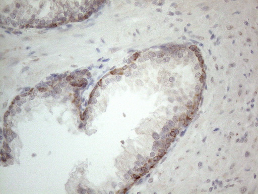 RORB / ROR Beta Antibody - Immunohistochemical staining of paraffin-embedded Human prostate tissue within the normal limits using anti-RORB mouse monoclonal antibody. (Heat-induced epitope retrieval by 1mM EDTA in 10mM Tris buffer. (pH8.5) at 120°C for 3 min. (1:150)