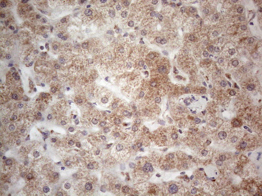 RORB / ROR Beta Antibody - Immunohistochemical staining of paraffin-embedded Human liver tissue within the normal limits using anti-RORB mouse monoclonal antibody. (Heat-induced epitope retrieval by 1mM EDTA in 10mM Tris buffer. (pH8.5) at 120°C for 3 min. (1:150)
