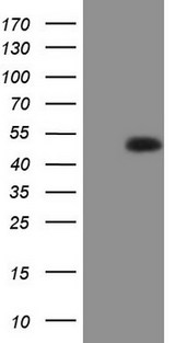 RORB / ROR Beta Antibody - HEK293T cells were transfected with the pCMV6-ENTRY control. (Left lane) or pCMV6-ENTRY RORB. (Right lane) cDNA for 48 hrs and lysed. Equivalent amounts of cell lysates. (5 ug per lane) were separated by SDS-PAGE and immunoblotted with anti-RORB. (1:2000)