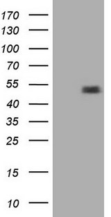 RORB / ROR Beta Antibody - HEK293T cells were transfected with the pCMV6-ENTRY control (Left lane) or pCMV6-ENTRY RORB (Right lane) cDNA for 48 hrs and lysed. Equivalent amounts of cell lysates (5 ug per lane) were separated by SDS-PAGE and immunoblotted with anti-RORB.