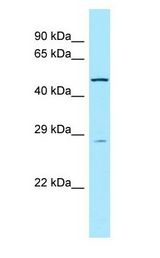 RORB / ROR Beta Antibody - RORB / ROR Beta antibody Western Blot of Rat Stomach.  This image was taken for the unconjugated form of this product. Other forms have not been tested.