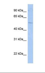 RORC / ROR Gamma Antibody - HepG2 cell lysate. Antibody concentration: 1.0 ug/ml. Gel concentration: 12%.  This image was taken for the unconjugated form of this product. Other forms have not been tested.