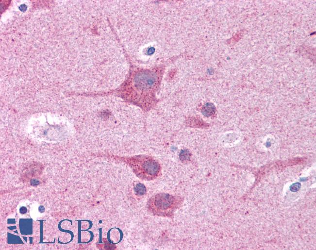 RORC / ROR Gamma Antibody - Anti-ROR Gamma antibody IHC of human brain, cortex. Immunohistochemistry of formalin-fixed, paraffin-embedded tissue after heat-induced antigen retrieval. Antibody concentration 5 ug/ml.  This image was taken for the unconjugated form of this product. Other forms have not been tested.