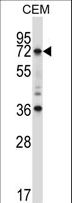 RORC / ROR Gamma Antibody - RORC Antibody western blot of CEM cell line lysates (35 ug/lane). The RORC antibody detected the RORC protein (arrow).