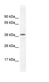 RORC / ROR Gamma Antibody - Fetal Kidney Lysate.  This image was taken for the unconjugated form of this product. Other forms have not been tested.