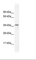 RORC / ROR Gamma Antibody - Fetal Kidney Lysate.  This image was taken for the unconjugated form of this product. Other forms have not been tested.