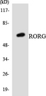 RORC / ROR Gamma Antibody - Western blot analysis of the lysates from HeLa cells using RORG antibody.