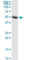 RORC / ROR Gamma Antibody - RORC monoclonal antibody (M01), clone 1G7. Western Blot analysis of RORC expression in human kidney.