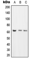 RORC / ROR Gamma Antibody - Western blot analysis of ROR gamma expression in Jurkat (A); NIH3T3 (B); PC12 (C) whole cell lysates.