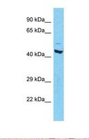 RORC / ROR Gamma Antibody - Western blot of Human Thyroid Tumor. RORC antibody dilution 1.0 ug/ml.  This image was taken for the unconjugated form of this product. Other forms have not been tested.