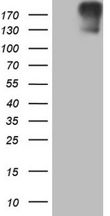 ROS1 / ROS Antibody - HEK293T cells were transfected with the pCMV6-ENTRY control. (Left lane) or pCMV6-ENTRY ROS1. (Right lane) cDNA for 48 hrs and lysed. Equivalent amounts of cell lysates. (5 ug per lane) were separated by SDS-PAGE and immunoblotted with anti-ROS1.