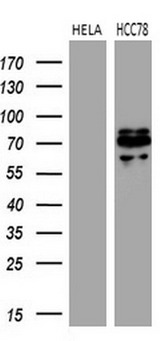 ROS1 / ROS Antibody - Western blot analysis of extracts. (35ug) from 2 different cell lines by using anti-ROS1 monoclonal antibody. (1:500)