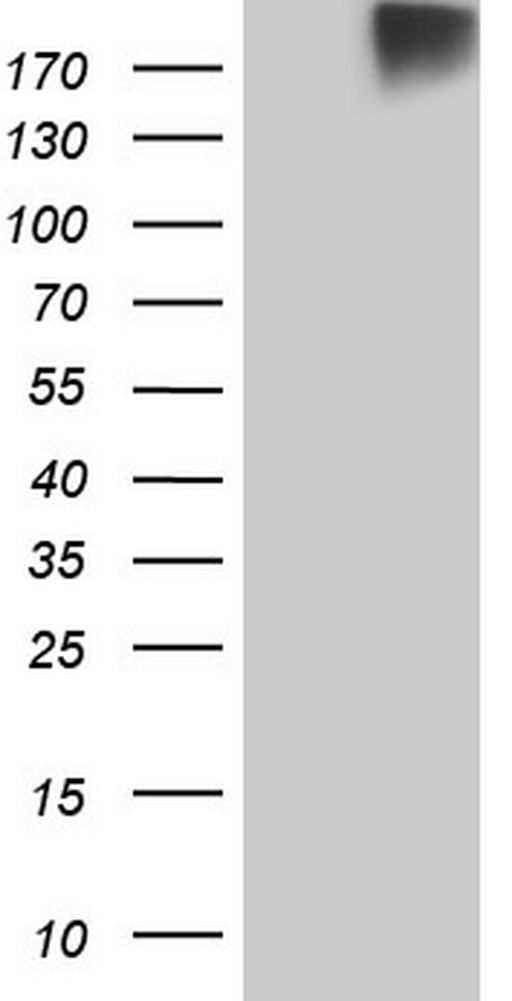 ROS1 / ROS Antibody - HEK293T cells were transfected with the pCMV6-ENTRY control. (Left lane) or pCMV6-ENTRY ROS1. (Right lane) cDNA for 48 hrs and lysed. Equivalent amounts of cell lysates. (5 ug per lane) were separated by SDS-PAGE and immunoblotted with anti-ROS1.