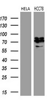 ROS1 / ROS Antibody - Western blot analysis of extracts. (35ug) from 2 different cell lines by using anti-ROS1 monoclonal antibody. (1:500)