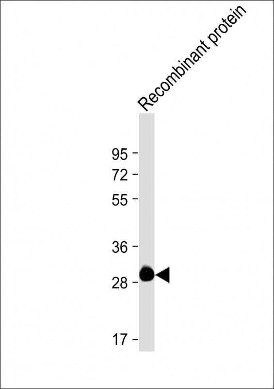ROS1 / ROS Antibody - Anti-ROS1 Antibody at 1:4000 dilution + Recombinant protein Lysates/proteins at 20ng per lane. Secondary Goat Anti-mouse IgG, (H+L), Peroxidase conjugated at 1/10000 dilution. Predicted band size: 264 kDa Blocking/Dilution buffer: 5% NFDM/TBST.