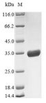 Outer Capsid Protein VP4 Protein - (Tris-Glycine gel) Discontinuous SDS-PAGE (reduced) with 5% enrichment gel and 15% separation gel.
