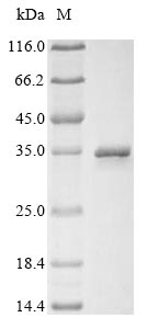 Outer Capsid Protein VP4 Protein - (Tris-Glycine gel) Discontinuous SDS-PAGE (reduced) with 5% enrichment gel and 15% separation gel.