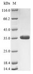 Rotavirus VP7 Protein - (Tris-Glycine gel) Discontinuous SDS-PAGE (reduced) with 5% enrichment gel and 15% separation gel.
