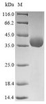 Influenza A H5N1 Hemagglutinin Protein - (Tris-Glycine gel) Discontinuous SDS-PAGE (reduced) with 5% enrichment gel and 15% separation gel.