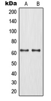 ROX / MNT Antibody - Western blot analysis of MNT expression in Jurkat (A); HeLa (B) whole cell lysates.