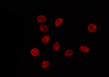 ROX / MNT Antibody - Staining HeLa cells by IF/ICC. The samples were fixed with PFA and permeabilized in 0.1% Triton X-100, then blocked in 10% serum for 45 min at 25°C. The primary antibody was diluted at 1:200 and incubated with the sample for 1 hour at 37°C. An Alexa Fluor 594 conjugated goat anti-rabbit IgG (H+L) Ab, diluted at 1/600, was used as the secondary antibody.