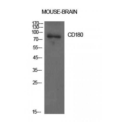 RP105 / CD180 Antibody - Western blot of CD180 antibody using whole mouse brain lysates.