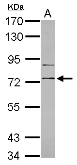RP105 / CD180 Antibody - Sample (30 ug of whole cell lysate) A: HL-60 7.5% SDS PAGE CD180 / RP105 antibody diluted at 1:1000