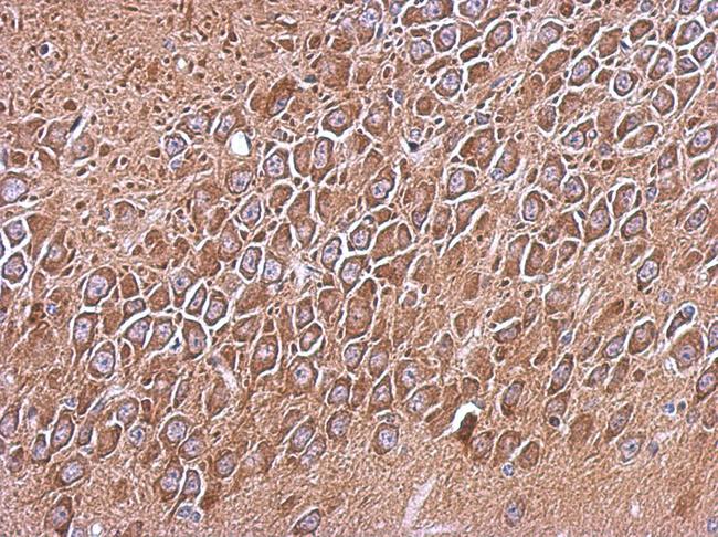 RP105 / CD180 Antibody - IHC of paraffin-embedded CL1-5 xenograft, using RP105 antibody at 1:500 dilution.