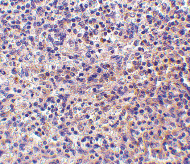 RP105 / CD180 Antibody - Immunohistochemistry of RP105 in human spleen tissue withRP105 antibody at 10 ug/ml.