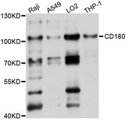 RP105 / CD180 Antibody - Western blot analysis of extracts of various cell lines, using CD180 antibody at 1:1000 dilution. The secondary antibody used was an HRP Goat Anti-Rabbit IgG (H+L) at 1:10000 dilution. Lysates were loaded 25ug per lane and 3% nonfat dry milk in TBST was used for blocking. An ECL Kit was used for detection and the exposure time was 1s.