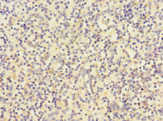 RP105 / CD180 Antibody - Immunohistochemistry of paraffin-embedded human spleen tissue at dilution 1:100