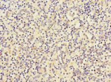 RP105 / CD180 Antibody - Immunohistochemistry of paraffin-embedded human spleen tissue at dilution 1:100