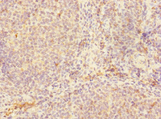 RP105 / CD180 Antibody - Immunohistochemistry of paraffin-embedded human tonsil tissue at dilution 1:100