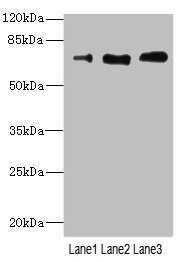 RP105 / CD180 Antibody - Western blot All Lanes: CD180 antibody at 3.95ug/ml Lane 1: A549 whole cell lysate Lane 2: A431 whole cell lysate Lane 3: HepG-2 whole cell lysate Secondary Goat polyclonal to rabbit IgG at 1/10000 dilution Predicted band size: 74 kDa Observed band size: 74 kDa