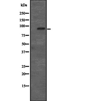RP105 / CD180 Antibody - Western blot analysis of CD180 expression in HEK293 cells. The lane on the left is treated with the antigen-specific peptide.