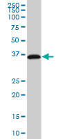 RP2 Antibody - RP2 monoclonal antibody (M01), clone 1B4. Western blot of RP2 expression in HeLa NE.