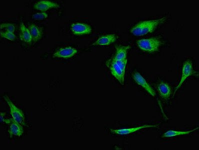 RP2 Antibody - Immunofluorescent analysis of Hela cells diluted at 1:100 and Alexa Fluor 488-congugated AffiniPure Goat Anti-Rabbit IgG(H+L)