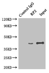 RP2 Antibody - Immunoprecipitating RP2 in Hela whole cell lysate Lane 1: Rabbit monoclonal IgG(1ug) instead of product in Hela whole cell lysate.For western blotting, a HRP-conjugated light chain specific antibody was used as the Secondary antibody (1/50000) Lane 2: product(4ug)+ Hela whole cell lysate(500ug) Lane 3: Hela whole cell lysate (20ug)
