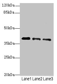 RP2 Antibody - Western blot All Lanes: RP2antibody at 3.81ug/ml Lane 1 : Jurkat whole cell lysate Lane 2 : HepG-2 whole cell lysate Lane 3 : Hela whole cell lysate Secondary Goat polyclonal to Rabbit IgG at 1/10000 dilution Predicted band size: 40 kDa Observed band size: 40 kDa