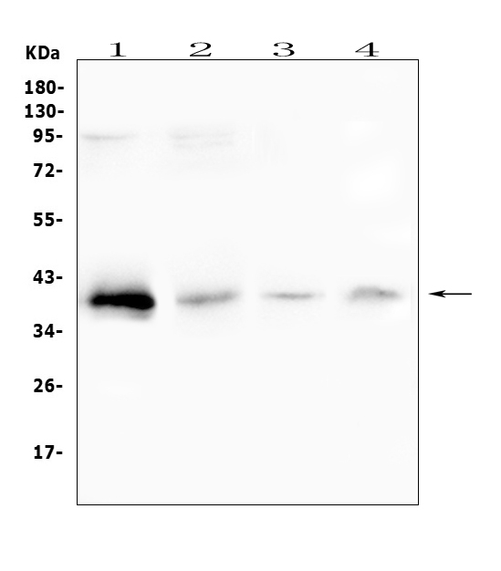 RP2 Antibody - Western blot analysis of RP2 using anti-RP2 antibody. Electrophoresis was performed on a 5-20% SDS-PAGE gel at 70V (Stacking gel) / 90V (Resolving gel) for 2-3 hours. The sample well of each lane was loaded with 50ug of sample under reducing conditions. Lane 1: human placenta tissue lysates,Lane 2: human SGC-7901 whole cell lysate,Lane 3: rat lung tissue lysates,Lane 4: mouse lung tissue lysates. After Electrophoresis, proteins were transferred to a Nitrocellulose membrane at 150mA for 50-90 minutes. Blocked the membrane with 5% Non-fat Milk/ TBS for 1.5 hour at RT. The membrane was incubated with rabbit anti-RP2 antigen affinity purified polyclonal antibody at 0.5 µg/mL overnight at 4°C, then washed with TBS-0.1% Tween 3 times with 5 minutes each and probed with a goat anti-rabbit IgG-HRP secondary antibody at a dilution of 1:10000 for 1.5 hour at RT. The signal is developed using an Enhanced Chemiluminescent detection (ECL) kit with Tanon 5200 system. A specific band was detected for RP2 at approximately 40KD. The expected band size for RP2 is at 40KD.