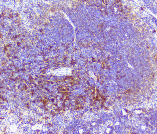 RP2 Antibody - IHC analysis of RP2 using anti-RP2 antibody. RP2 was detected in paraffin-embedded section of mouse spleen tissue. Heat mediated antigen retrieval was performed in citrate buffer (pH6, epitope retrieval solution) for 20 mins. The tissue section was blocked with 10% goat serum. The tissue section was then incubated with 1µg/ml rabbit anti-RP2 Antibody overnight at 4°C. Biotinylated goat anti-rabbit IgG was used as secondary antibody and incubated for 30 minutes at 37°C. The tissue section was developed using Strepavidin-Biotin-Complex (SABC) with DAB as the chromogen.