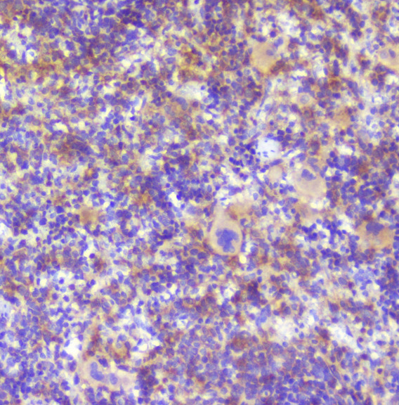 RP2 Antibody - IHC analysis of RP2 using anti-RP2 antibody. RP2 was detected in paraffin-embedded section of rat spleen tissue. Heat mediated antigen retrieval was performed in citrate buffer (pH6, epitope retrieval solution) for 20 mins. The tissue section was blocked with 10% goat serum. The tissue section was then incubated with 1µg/ml rabbit anti-RP2 Antibody overnight at 4°C. Biotinylated goat anti-rabbit IgG was used as secondary antibody and incubated for 30 minutes at 37°C. The tissue section was developed using Strepavidin-Biotin-Complex (SABC) with DAB as the chromogen.